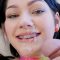 From $5.00 – Brace Faced Discount (Save 84%)